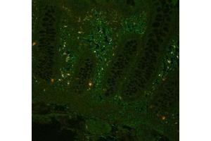 Image no. 3 for anti-Tumor Necrosis Factor alpha (TNF alpha) antibody (ABIN799618) (TNF alpha antibody)