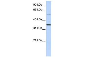 ANKRD9 antibody used at 1 ug/ml to detect target protein. (ANKRD9 antibody  (Middle Region))