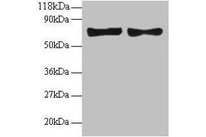 Western blot All lanes: CCL5 antibody at 2 μg/mL Lane 1: EC109 whole cell lysate Lane 2: 293T whole cell lysate Secondary Goat polyclonal to rabbit IgG at 1/15000 dilution Predicted band size: 10 kDa Observed band size: 70 kDa (CCL5 antibody  (AA 24-91))