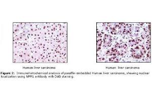 Image no. 1 for anti-Nucleophosmin (Nucleolar phosphoprotein B23, Numatrin) (NPM1) antibody (ABIN207591) (NPM1 antibody)