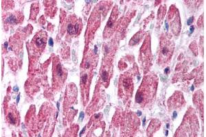 Image no. 1 for anti-Sodium Channel, Nonvoltage-Gated 1, beta (SCNN1B) (C-Term) antibody (ABIN6736428)
