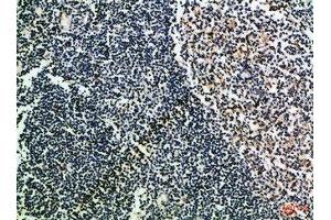 Immunohistochemical analysis of paraffin-embedded Human-tonsil, antibody was diluted at 1:100 (CD52 antibody  (AA 20-50))