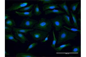Immunofluorescence of purified MaxPab antibody to PSMB3 on HeLa cell.
