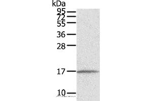 Western blot analysis of Human normal liver tissue, using EVA1A Polyclonal Antibody at dilution of 1:550 (TMEM166 antibody)
