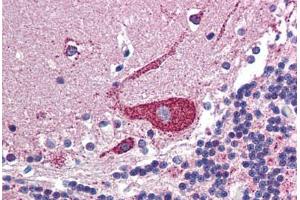 Human Brain, Cerebellum: Formalin-Fixed, Paraffin-Embedded (FFPE) (ARF6 antibody  (C-Term))