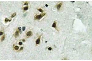Immunohistochemistry  (IHC) analyzes of TFIIIC102 antibody in paraffin-embedded human brain tissue. (GTF3C3 antibody)