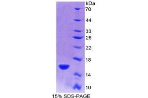 SDS-PAGE (SDS) image for R-Spondin 1 (RSPO1) (AA 21-135) protein (His tag) (ABIN2121981) (RSPO1 Protein (AA 21-135) (His tag))
