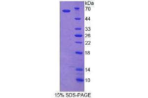 Image no. 1 for ATP-Binding Cassette, Sub-Family D (Ald), Member 1 (ABCD1) (AA 102-386) protein (ABIN6239359) (ABCD1 Protein (AA 102-386))