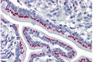 Human Small Intestine: Formalin-Fixed, Paraffin-Embedded (FFPE) (GOLM1 antibody  (AA 302-402))