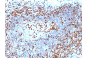 Formalin-fixed, paraffin-embedded human Lymph Node stained with ZAP70 Mouse Monoclonal Antibody (ZAP70/2046). (ZAP70 antibody  (AA 247-382))