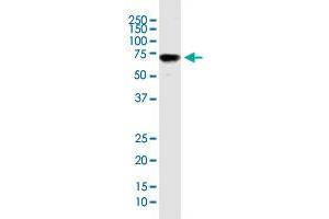 ENG monoclonal antibody (M26), clone 1E5. (Endoglin antibody  (AA 27-658))