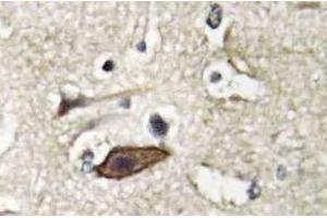 Immunohistochemistry (IHC) analyzes of Tsg 101 antibody in paraffin-embedded human brain tissue. (TSG101 antibody)