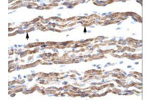 Image no. 1 for anti-Polyglutamine Binding Protein 1 (PQBP1) (AA 58-107) antibody (ABIN202137) (PQBP1 antibody  (AA 58-107))