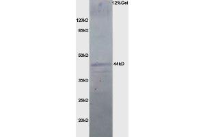 Rat brain lysate probed with Anti PDSS2 Polyclonal Antibody, Unconjugated (ABIN1386354) at 1:200 in 4 °C. (PDSS2 antibody  (AA 21-100))