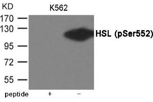 Western blot analysis of extracts from K562 cells using HSL (Phospho-Ser552) Antibody. (LIPE antibody  (pSer552))