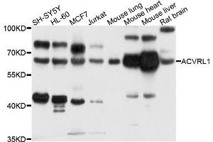 Western blot analysis of extracts of various cell lines, using ACVRL1 antibody (ABIN5996082) at 1/1000 dilution. (ACVRL1 antibody)