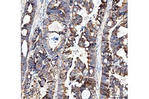 IHC analysis of MUT using anti-MUT antibody (ABIN4886676). (MUT antibody  (N-Term))