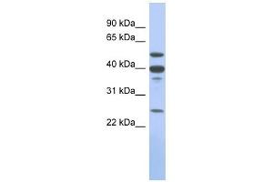 MMP13 antibody used at 1 ug/ml to detect target protein. (MMP13 antibody)