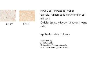 Sample Type: Human Optic Nerve and Spinal CordCellular Target: Oligoden Drocyte Lineage CellsPrimary Dilution: IHC-PZ 1:500, IHC-P 1:1000 (Nkx2-2 antibody  (N-Term))