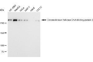 Western blotting analysis using Chromodomain helicase DNA binding protein 3 antibody (ABIN7798069). (Recombinant CHD3 antibody)