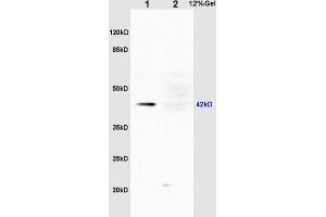 L1 rat liver lysates L2 rat kidney lysates probed with Rabbit Anti-ERK1 (Thr203/Tyr205) + ERK2 (Thr183/Tyr185) Polyclonal Antibody, Unconjugated (ABIN687727) at 1:200 overnight at 4 °C. (ERK1/2 antibody  (pThr183, pTyr185))