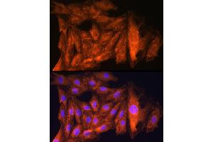 Immunofluorescence (IF) image for anti-Cytoskeleton Associated Protein 5 (CKAP5) (AA 1763-2032) antibody (ABIN6138647)