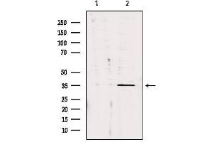 Western blot analysis of extracts from 293, using CA13 Antibody. (CA13 antibody  (Internal Region))