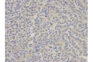 Immunohistochemistry (IHC) image for anti-Proteasome (Prosome, Macropain) 26S Subunit, ATPase, 2 (PSMC2) antibody (ABIN1874379) (PSMC2 antibody)