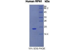 SDS-PAGE (SDS) image for Ribophorin 1 (RPN1) (AA 180-307) protein (His tag) (ABIN1525576)