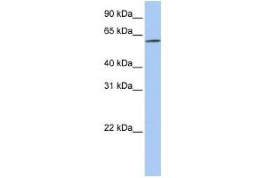 WB Suggested Anti-SLC22A14 Antibody Titration:  0. (SLC22A14 antibody  (N-Term))