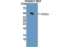 Detection of Recombinant IL11Ra, Rat using Polyclonal Antibody to Interleukin 11 Receptor Alpha (IL11Ra) (IL11RA antibody  (AA 24-371))