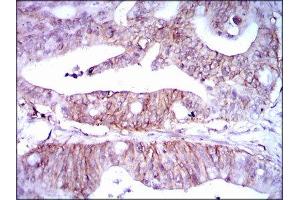 Immunohistochemistry (IHC) image for anti-Lipoprotein (Lp(a)) (AA 4330-4521) antibody (ABIN1845714) (Lp(a) antibody  (AA 4330-4521))