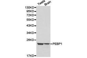 Western Blotting (WB) image for anti-Phosphatidylethanolamine Binding Protein 1 (PEBP1) antibody (ABIN1874092)