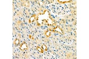 Immunohistochemistry of paraffin embedded rat kidney using Dmac2l (ABIN7073751) at dilution of 1: 650 (400x lens) (Distal Membrane Arm Assembly Complex 2 L Homeolog (DMAC2.L) antibody)