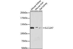 Western blot analysis of extracts of various cell lines, using SLC12A7 antibody (ABIN6292577) at 1:1000 dilution. (SLC12A7 antibody)