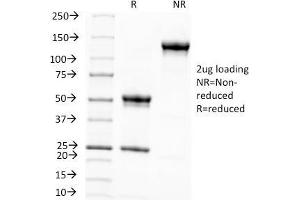 SDS-PAGE Analysis Purified Melanoma Monoclonal Antibody (KBA. (Melanoma Associated Antigen (KBA.62) antibody)
