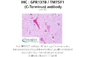 Image no. 2 for anti-G Protein-Coupled Receptor 137B (GPR137B) (C-Term) antibody (ABIN1734939) (GPR137B antibody  (C-Term))