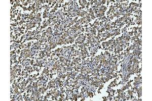 IHC analysis of ARL13B using anti-ARL13B antibody (ABIN7600179). (ARL13B antibody  (AA 16-428))