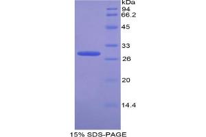 SDS-PAGE analysis of Cow Transportin 1 Protein.