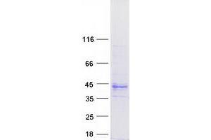 Western Blotting (WB) image for Transmembrane Protein 231 (TMEM231) (Transcript Variant 3) protein (Myc-DYKDDDDK Tag) (ABIN2723165)