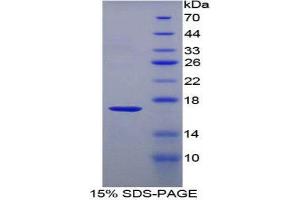 SDS-PAGE (SDS) image for T-Cell Leukemia/lymphoma 1A (TCL1A) (AA 6-112) protein (His tag) (ABIN2126906)