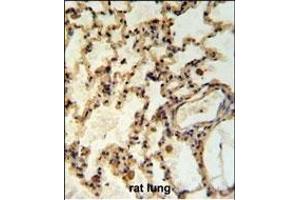 IL Antibody (Center) (ABIN653951 and ABIN2843173) IHC analysis in formalin fixed and paraffin embedded rat lung tisssue followed by peroxidase conjugation of the secondary antibody and DAB staining. (IMMP2L antibody  (AA 81-109))