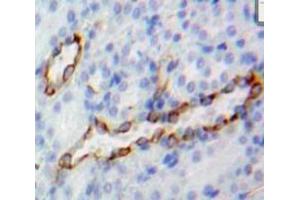 Used in DAB staining on fromalin fixed paraffin-embedded Kidney tissue (CD73 antibody  (AA 29-550))