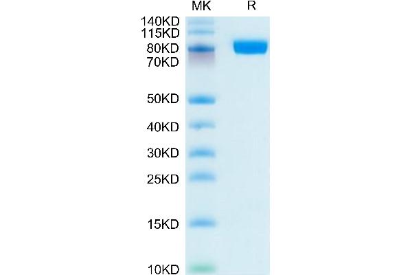 MME Protein (AA 52-750) (His tag)