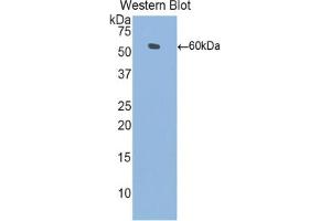 Western blot analysis of the recombinant protein. (L1CAM antibody  (AA 882-1132))