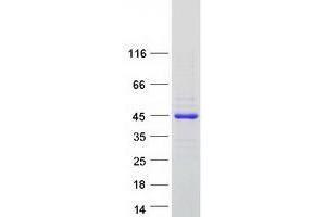 Western Blotting (WB) image for Ubiquitin-Conjugating Enzyme E2 Variant 1 (UBE2V1) (Transcript Variant 1) protein (Myc-DYKDDDDK Tag) (ABIN2734876)
