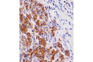 (ABIN6243770 and ABIN6577238) staining REG3G in human pancreas tissue sections by Immunohistochemistry (IHC-P - paraformaldehyde-fixed, paraffin-embedded sections). (REG3g antibody)