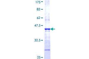WASP Protein (AA 57-170) (GST tag)