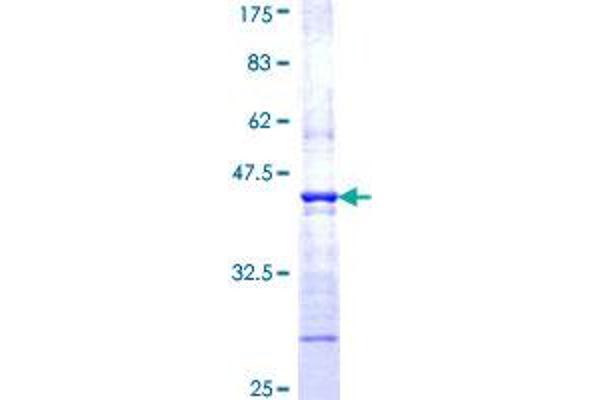 WASP Protein (AA 57-170) (GST tag)