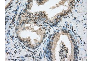 Immunohistochemical staining of paraffin-embedded colon tissue using anti-ACSBG1 mouse monoclonal antibody. (ACSBG1 antibody)
